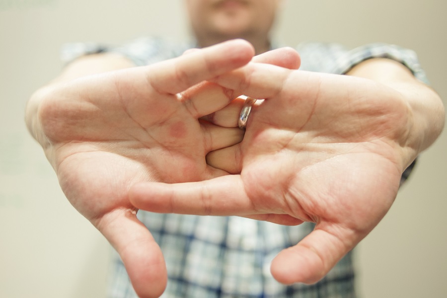 Cracking Knuckles A harmless habit or something dangerous? The